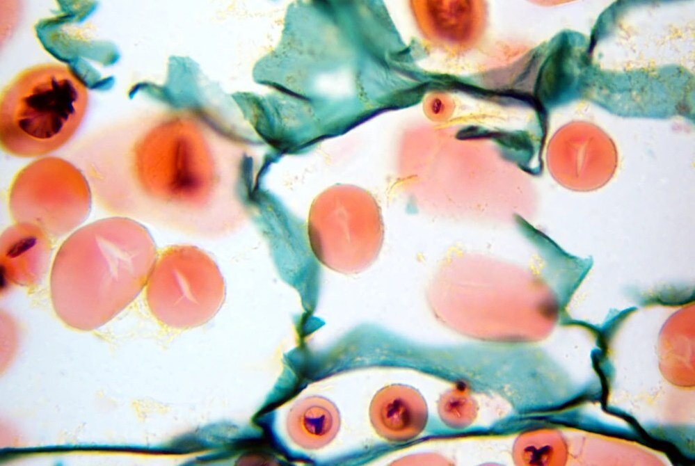 Mikroskop DELTA OPTICAL Genetic Trino  obiektywy