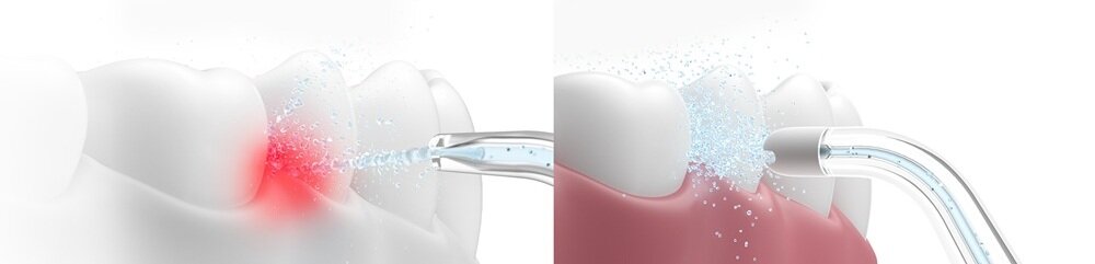 Irygator OCLEAN A10 Biały technologia AirPump, połączenie wody i powietrza, delikatne i komfortowe czyszczenie